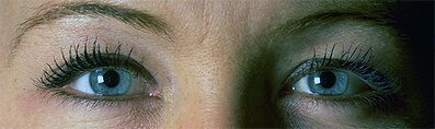 eyes