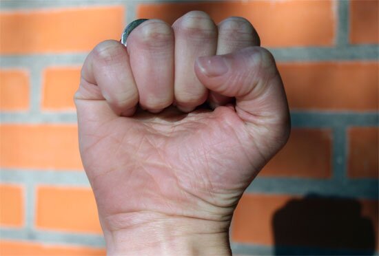 fistus fistus